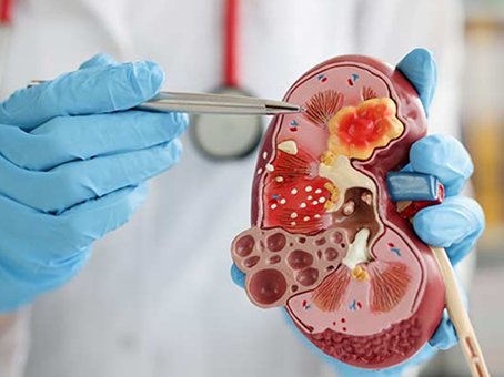 Nephrology